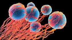 Colorectal cancer accordion image