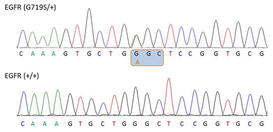 Chromatograph showing heterozygosity for the EGFR G719S mutation within EGFR (SNP accession number: rs28929495)