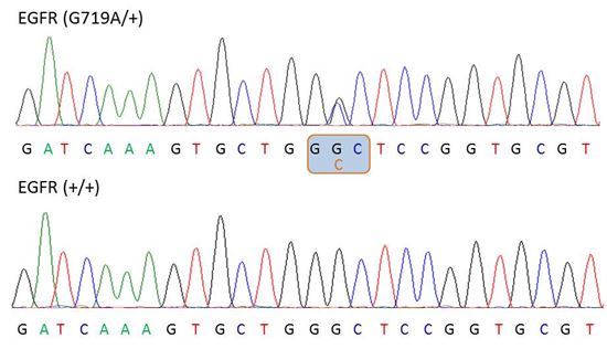 Chromatograph showing heterozygosity for the EGFR G719A mutation within EGFR (SNP accession number: rs121913428) Chromatograph showing heterozygosity for the EGFR G719A mutation within EGFR (SNP accession number: rs121913428)
