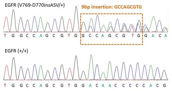 Chromatograph showing heterozygosity for the EGFR V769-D770insASV mutation within EGFR