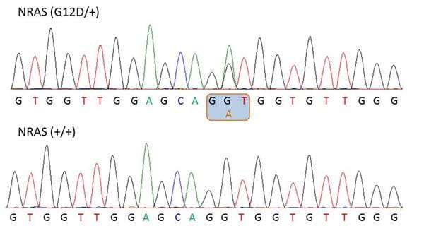 Chromatograph showing heterozygosity for the N-Ras (G12D) mutation within N-Ras