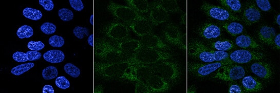 calr-gene-turbo-gfp-tagged-endoplasmic-reticulum