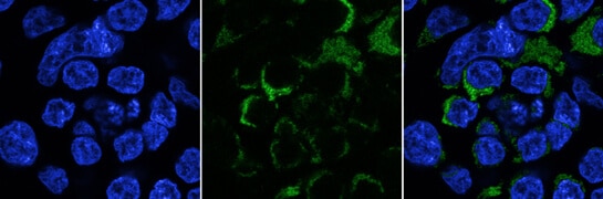 hk1-gene-turbogfp-tagged-mitochondria