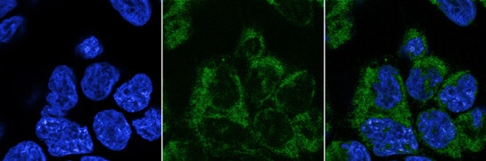 pdia4-gene-turbogfp-tagged-endoplasmic-reticulum