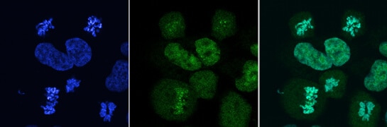 top2a-gene-turbo-gfp-tagged-nucleus