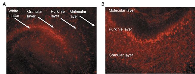 Accell control siRNA demonstrates effective uptake and silencing in organotypic brain slices
