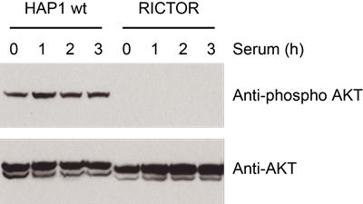 AKT Phosphorylation Images
