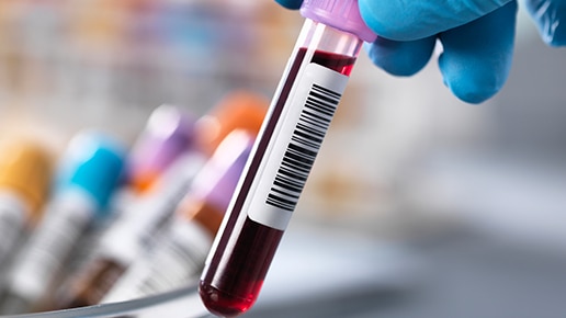 Reference standards for liquid biospy