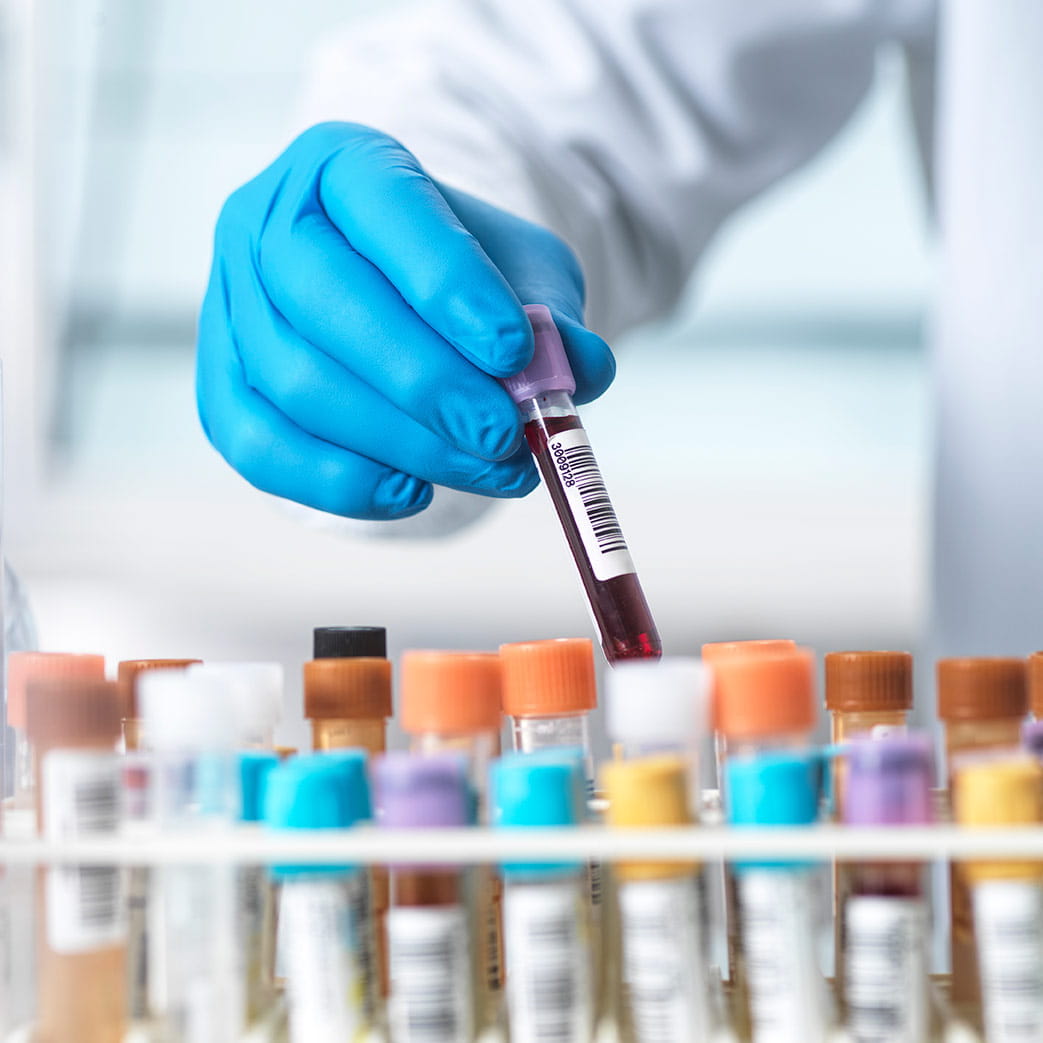 Reference standard by sample type