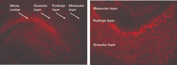 organotypic brain slices
